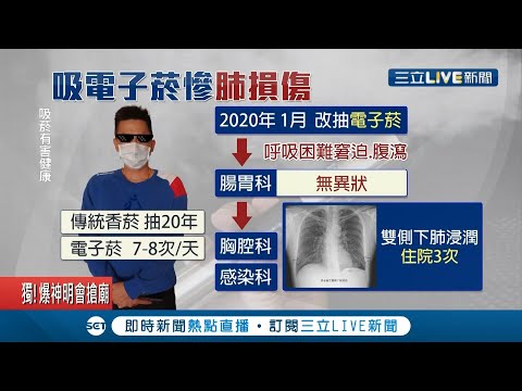 男子原本是不看病”的鋼鐵人..改抽電子菸半年竟出現肺炎症狀 成了台成人通報首例｜記者 林昆慶 曾建勳｜【LIVE大現場】20210209｜三立新聞台